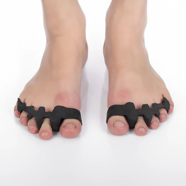Toe Bliss Separatoren — Sofortiger Komfort, natürliche Anpassung