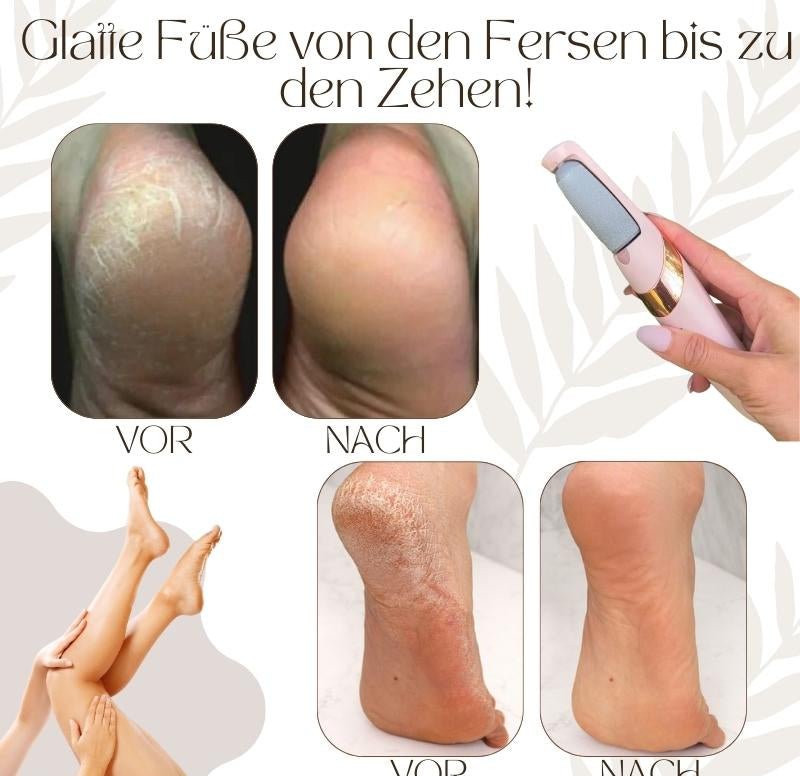 VelvoEase — Silke Glatte Fødder